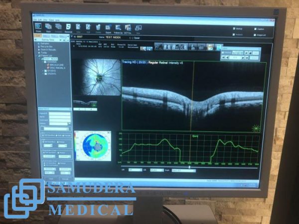 Sale - Nidek RS-3000 Advance 2 Optical Coherence Tomography - Image 5