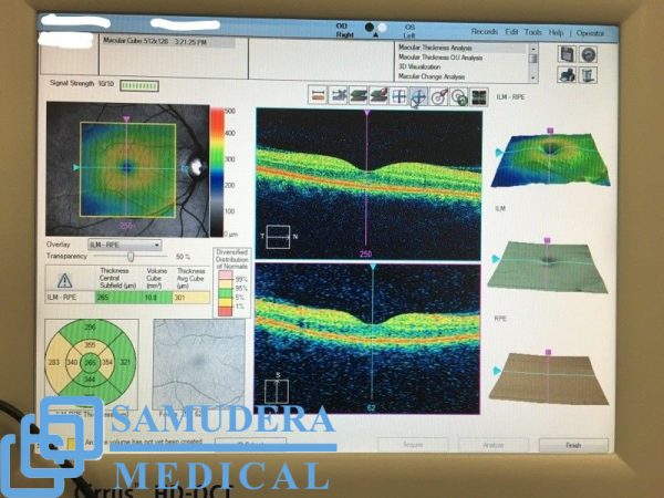Sale - Carl Zeiss Cirrus 4000 HD OCT - Image 8
