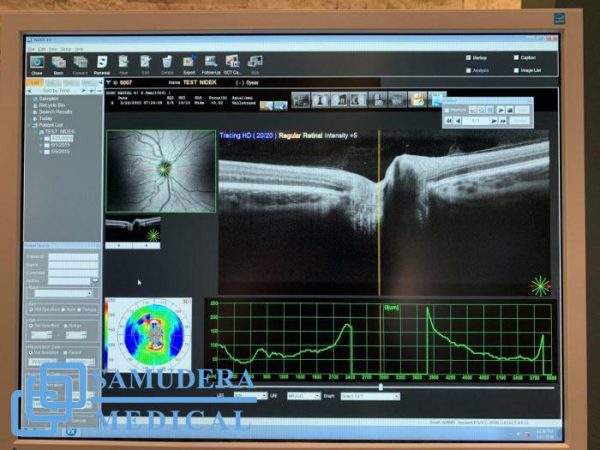 Sale - Nidek RS-3000 Advance 2 Optical Coherence Tomography - Image 3